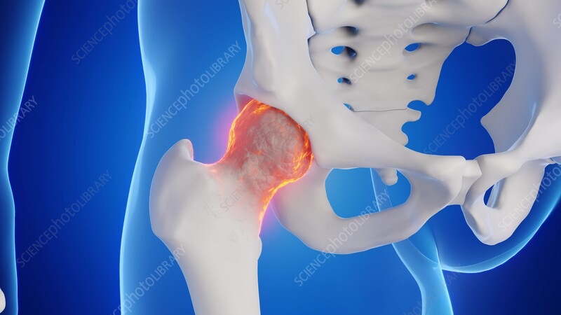 Unlocking hip mobility for a pain free back